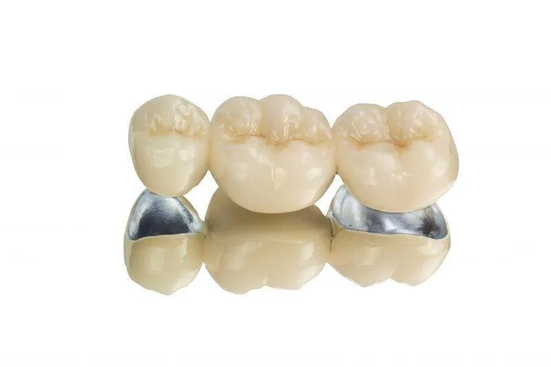 Металлокерамические коронки в Калининграде — протезирование зубов